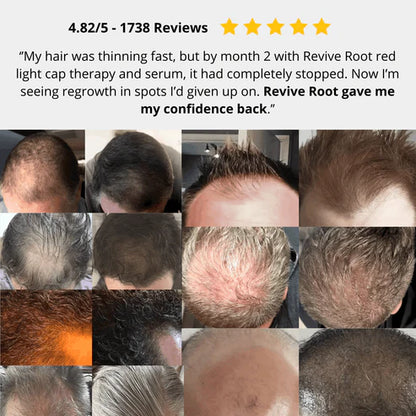 Red Light Therapy Cap for Hair Regrowth Treatments - RevitaCap