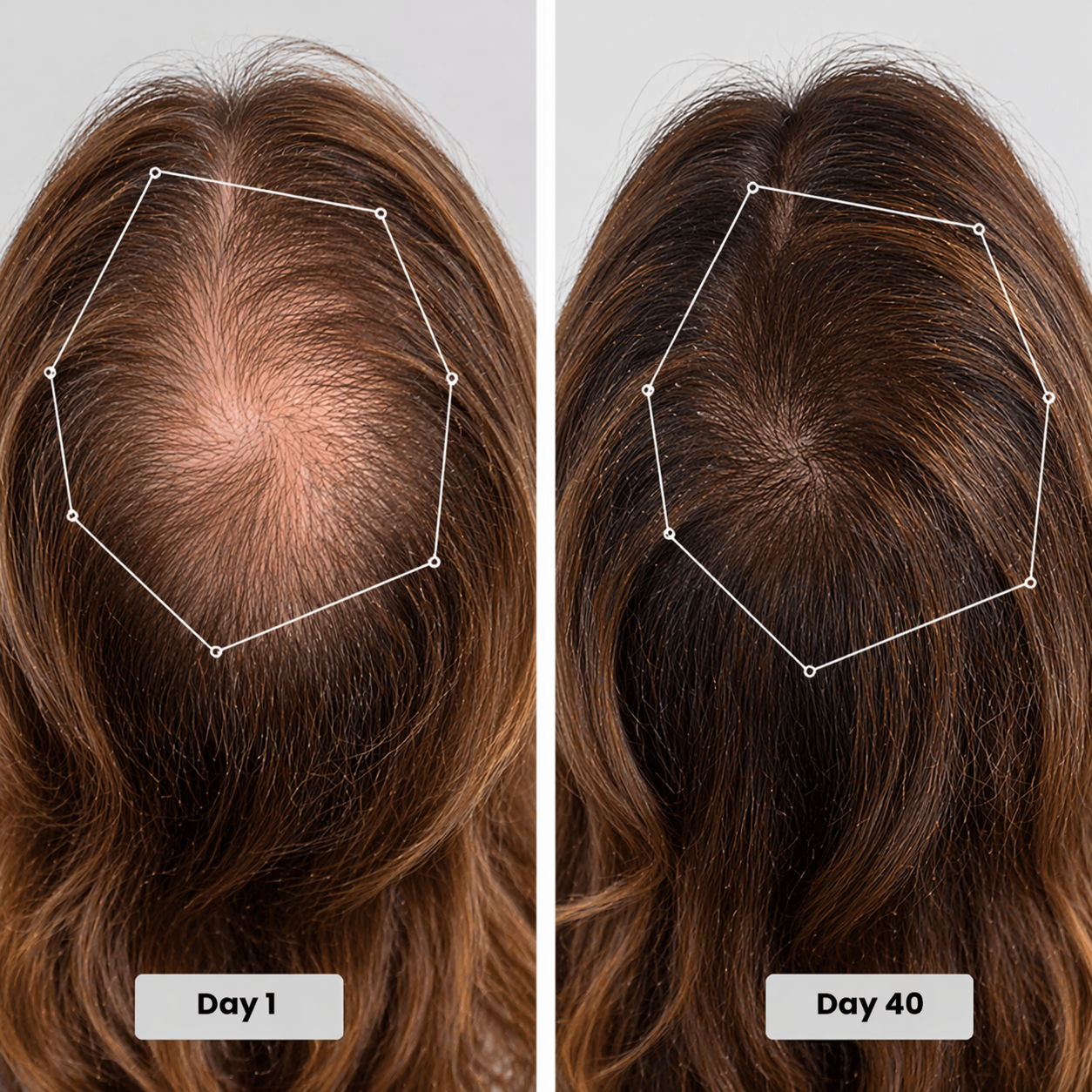 Red Light Therapy Cap for Hair Regrowth Treatments - RevitaCap